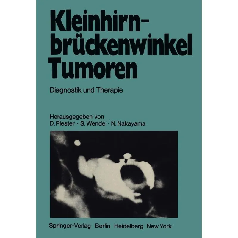 Kleinhirnbrückenwinkel-Tumoren