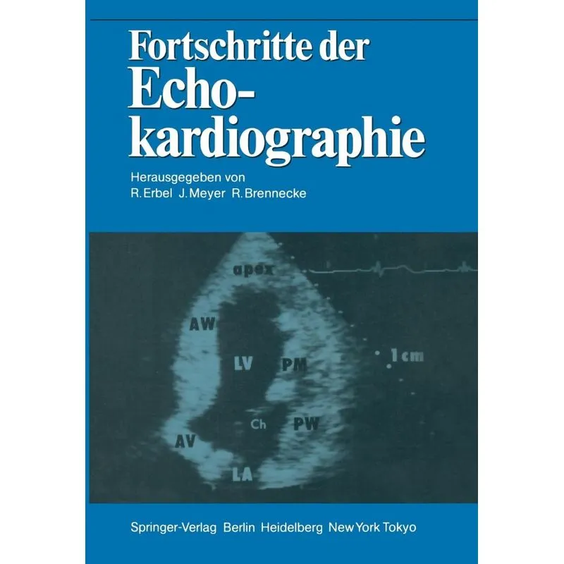 Fortschritte der Echokardiographie