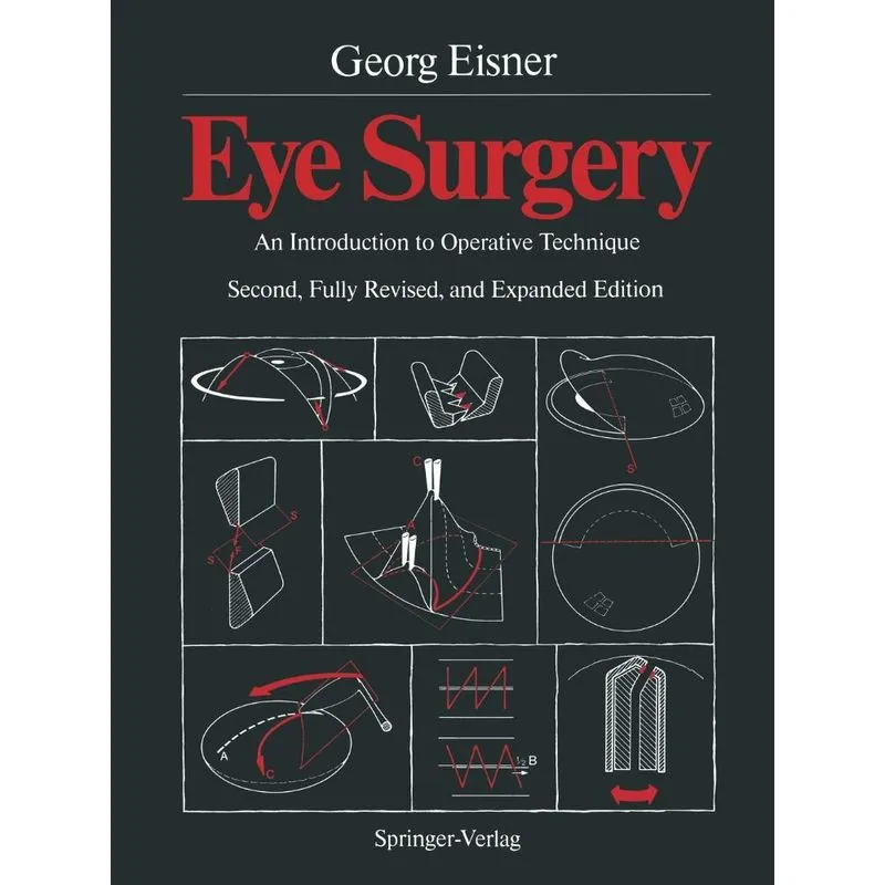 Eye Surgery