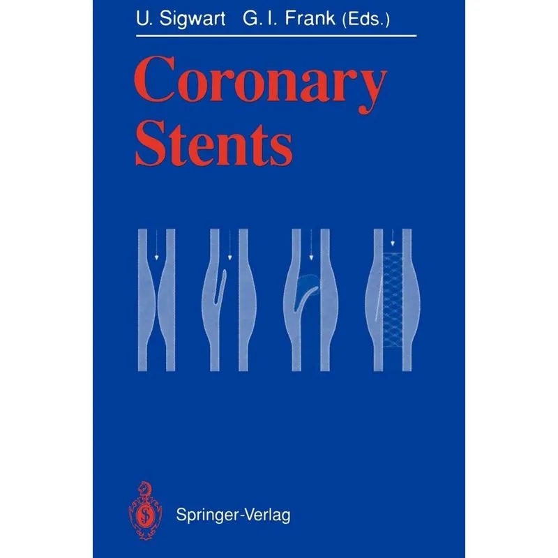 Coronary Stents