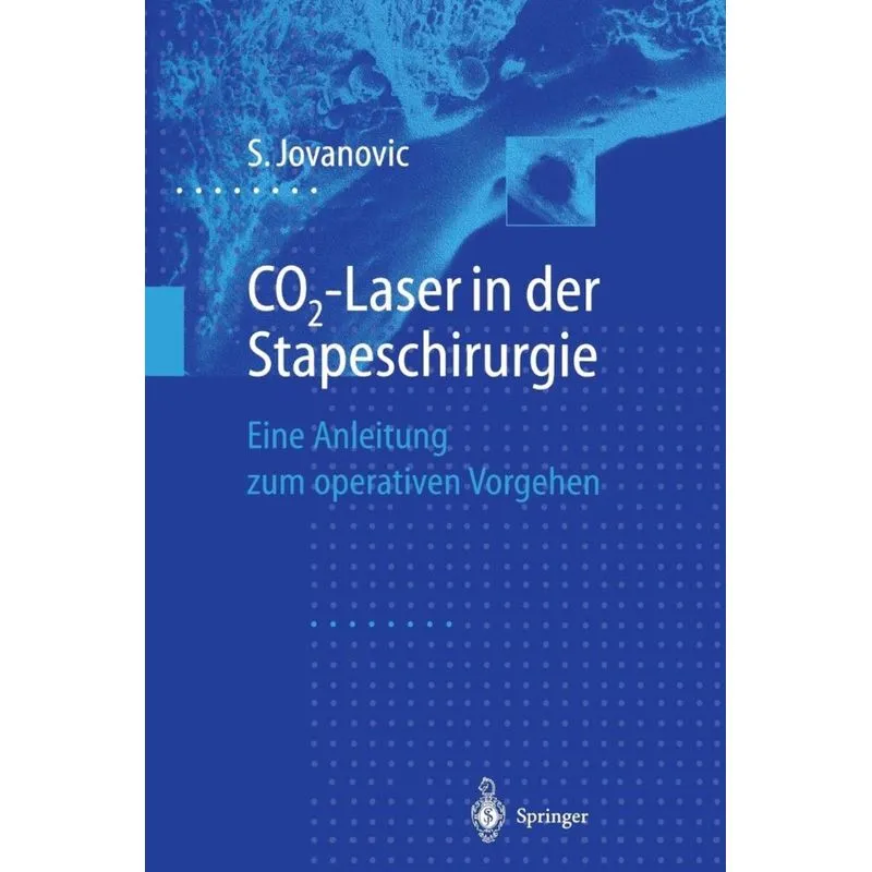 Co2-Laser in Der Stapeschirurgie