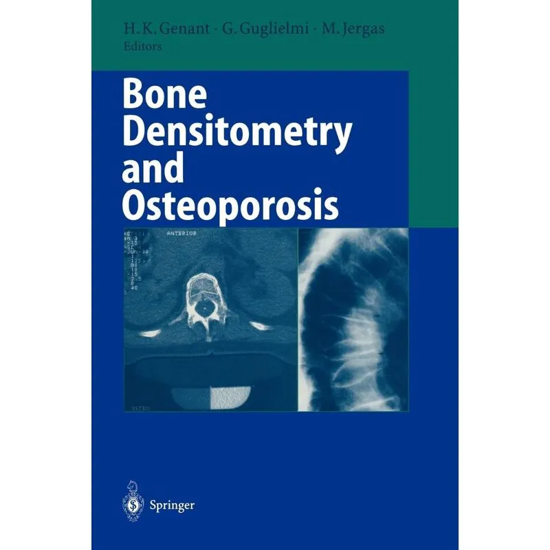 Bone Densitometry and Osteoporosis