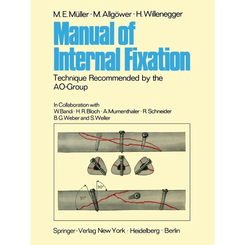 Manual of Internal Fixation