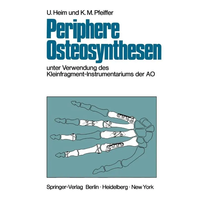 Periphere Osteosynthesen