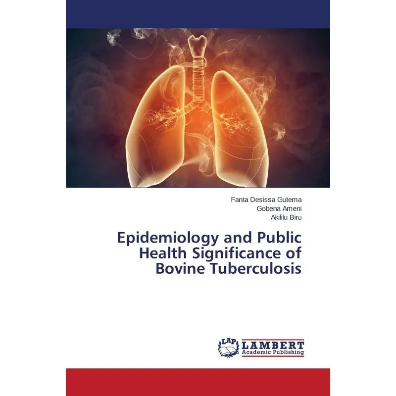Epidemiology and Public Health Significance of Bovine Tuber