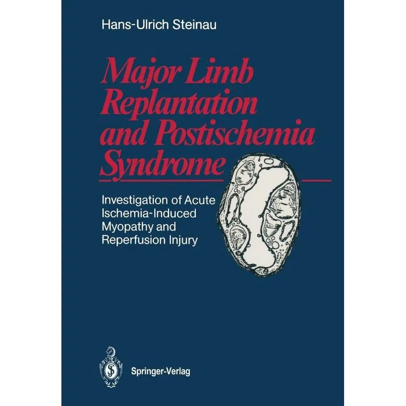 Major Limb Replantation and Postischemia Syndrome
