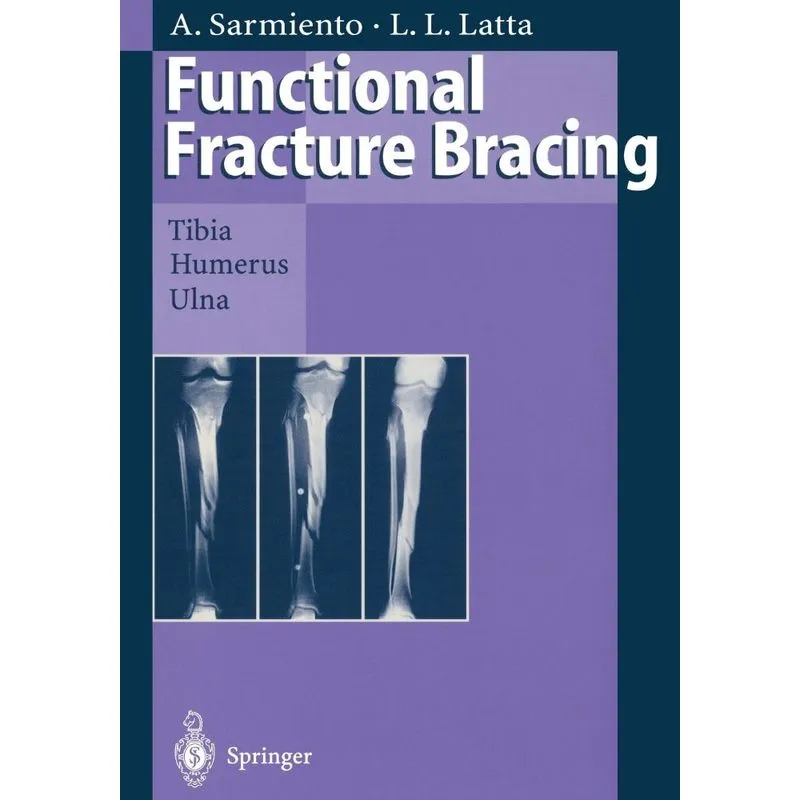 Functional Fracture Bracing