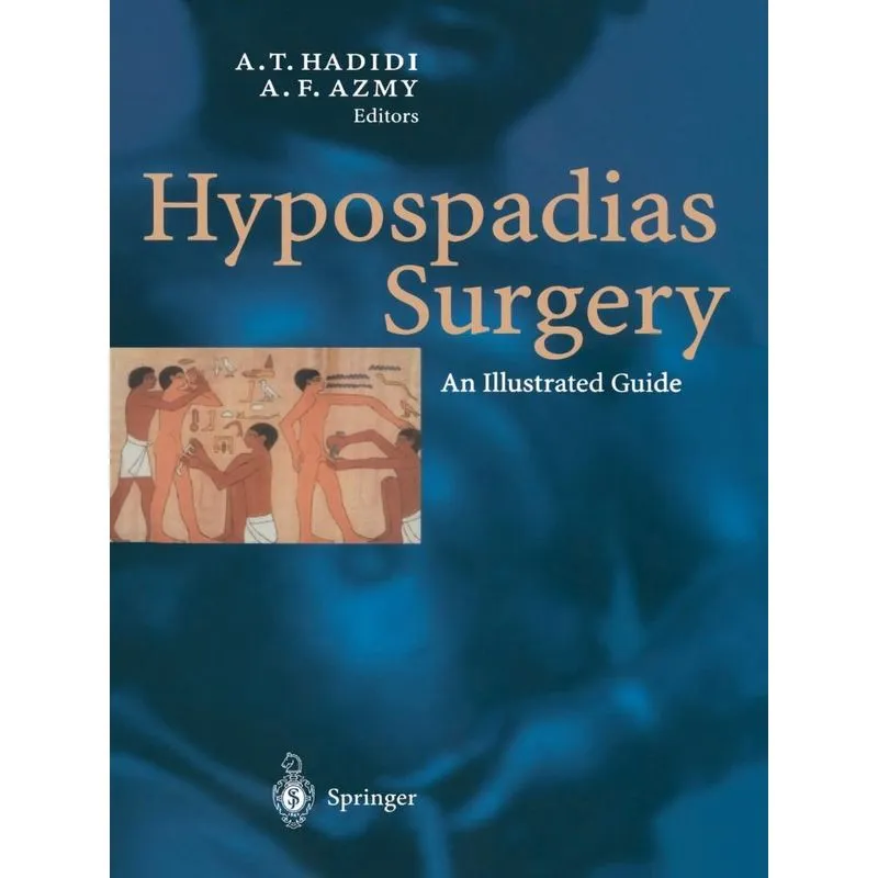 Hypospadias Surgery