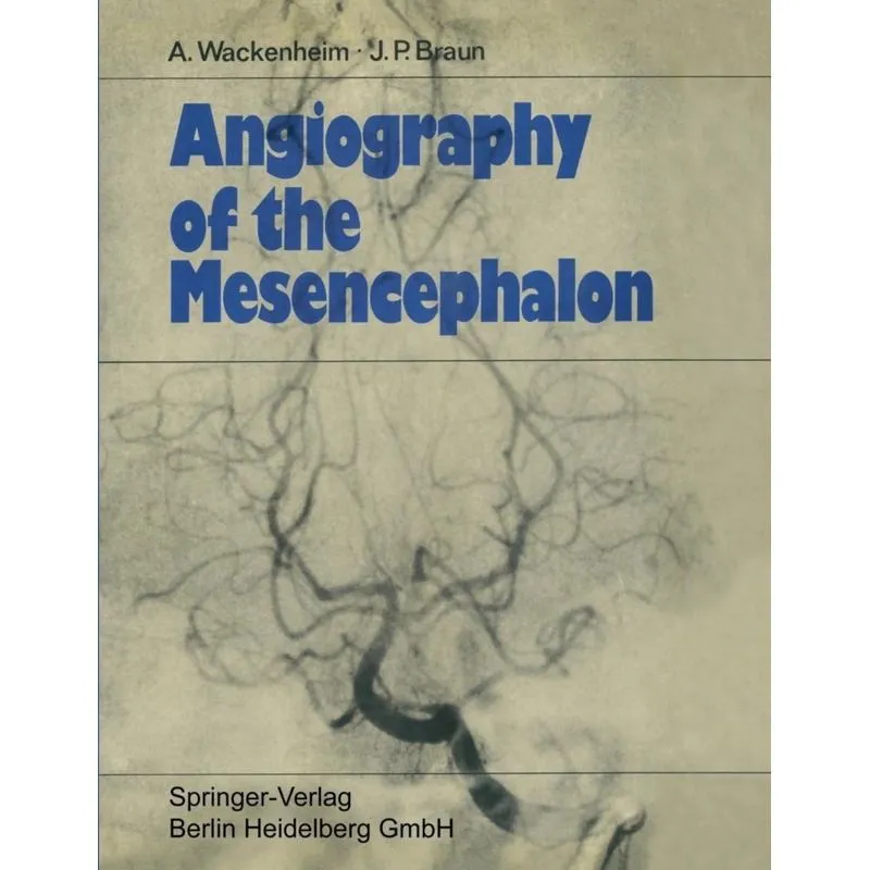 Angiography of the Mesencephalon