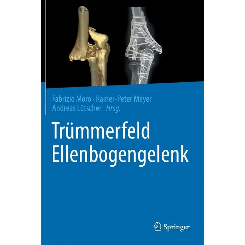 Trümmerfeld Ellenbogengelenk
