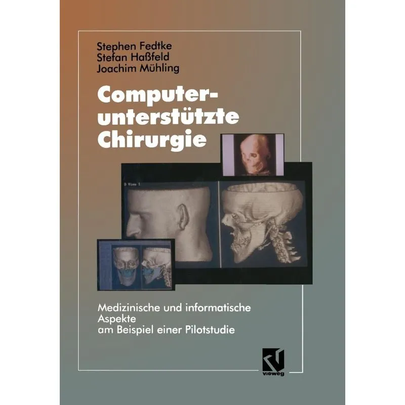 Computerunterstutzte Chirurgie