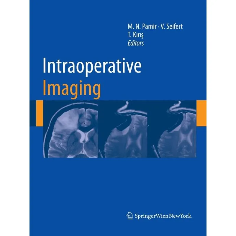 Intraoperative Imaging