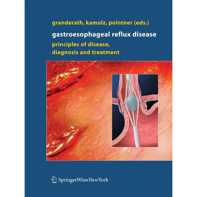 Gastroesophageal Reflux Disease