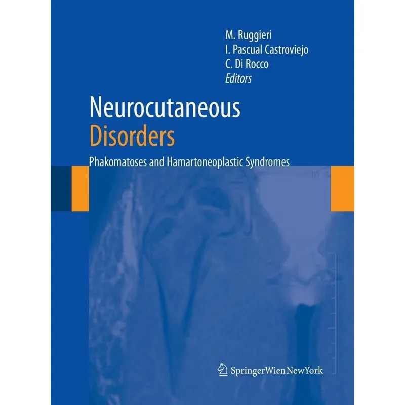 Neurocutaneous Disorders