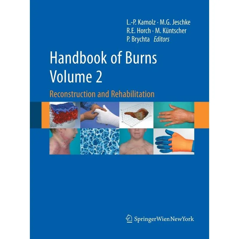 Handbook of Burns Volume 2