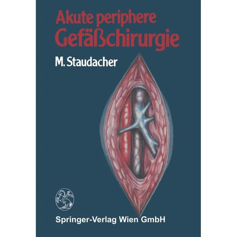 Akute periphere Gefäßchirurgie