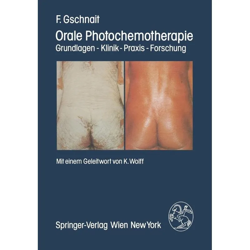 Orale Photochemotherapie