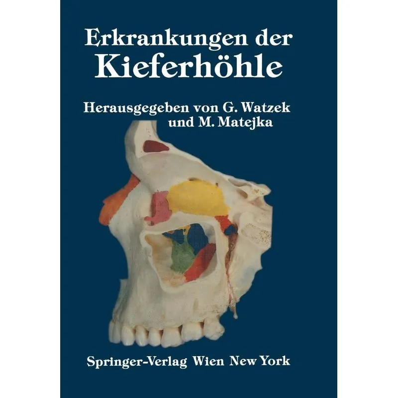 Erkrankungen der Kieferhöhle