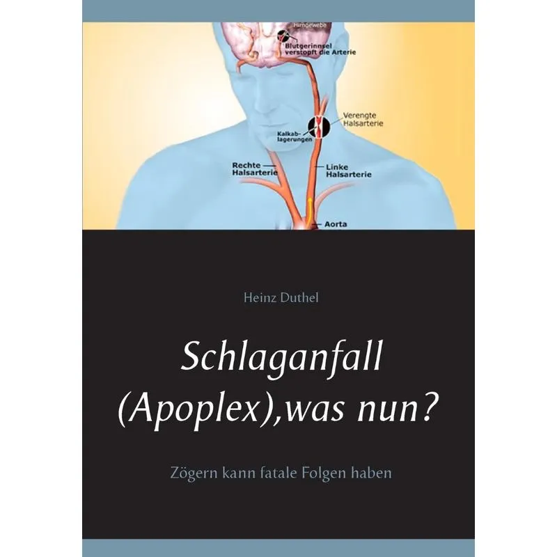 Schlaganfall (Apoplex), was nun?