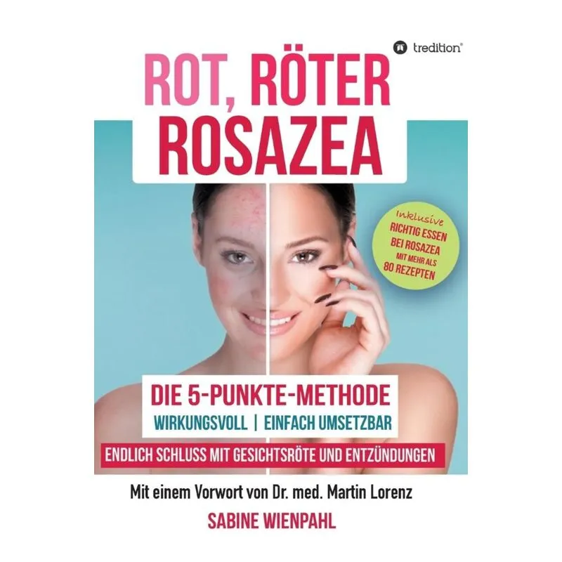 ROT RÖTER ROSAZEA