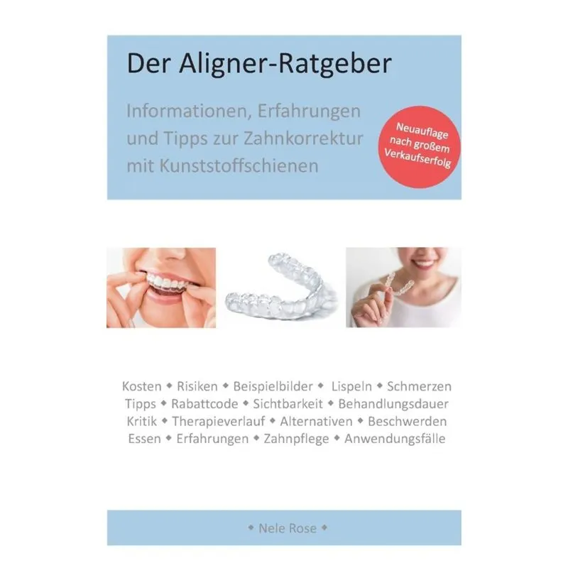 Der Aligner-Ratgeber