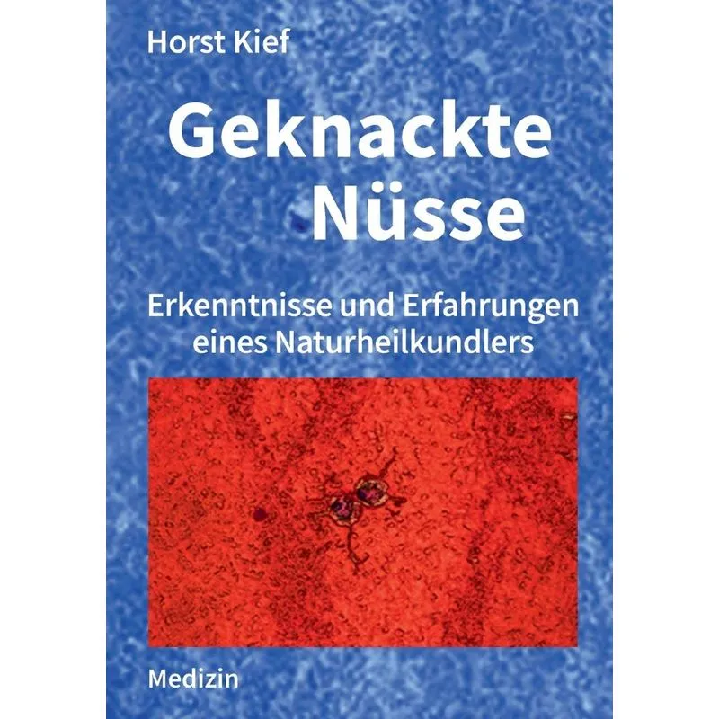 Geknackte Nüsse