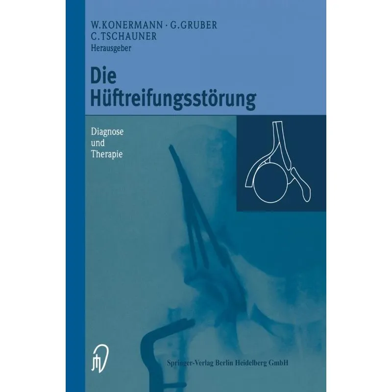 Die Huftreifungsstorung