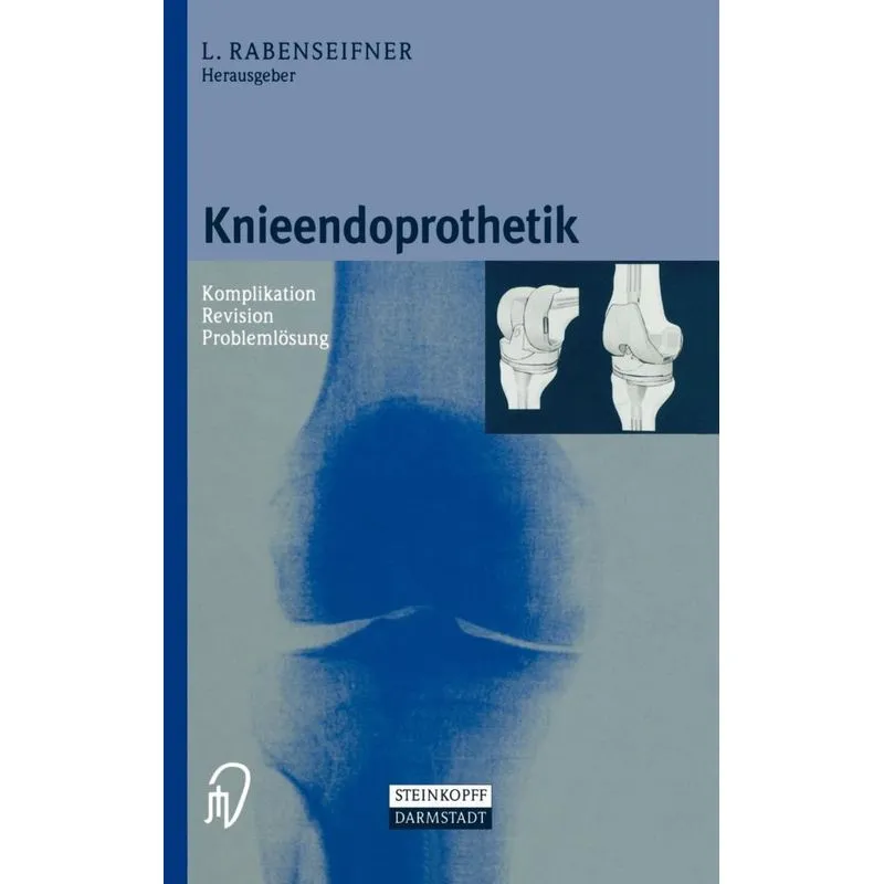 Knieendoprothetik