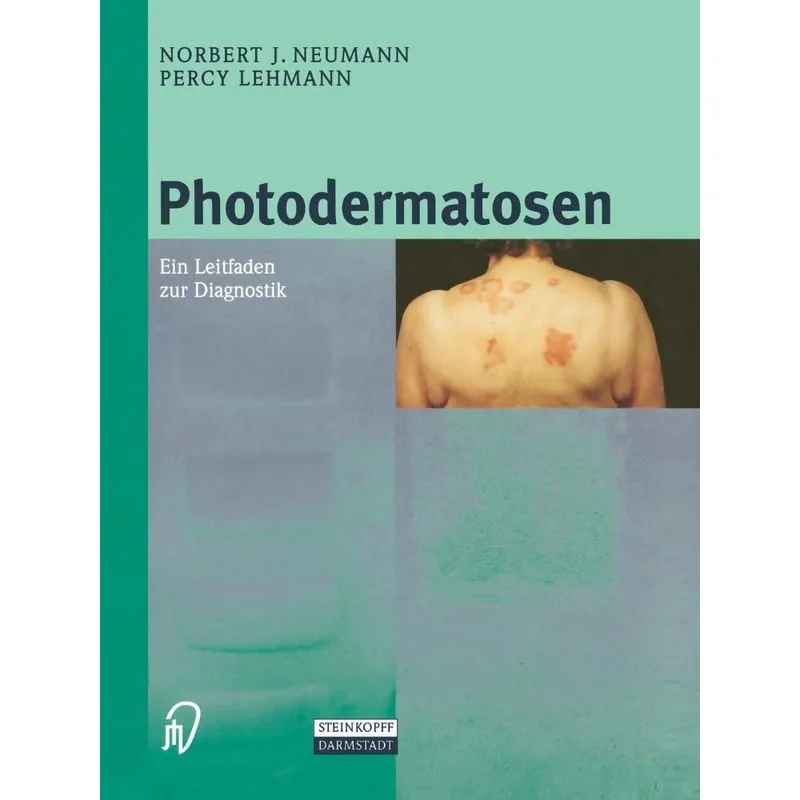 Photodermatosen