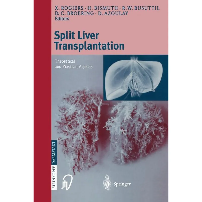Split liver transplantation