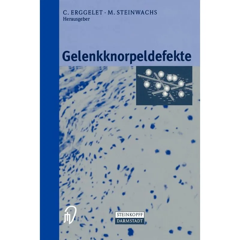 Gelenkknorpeldefekte
