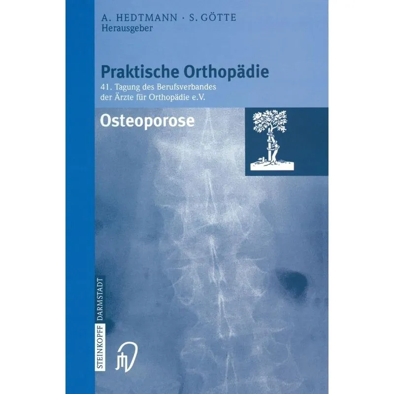 Osteoporose