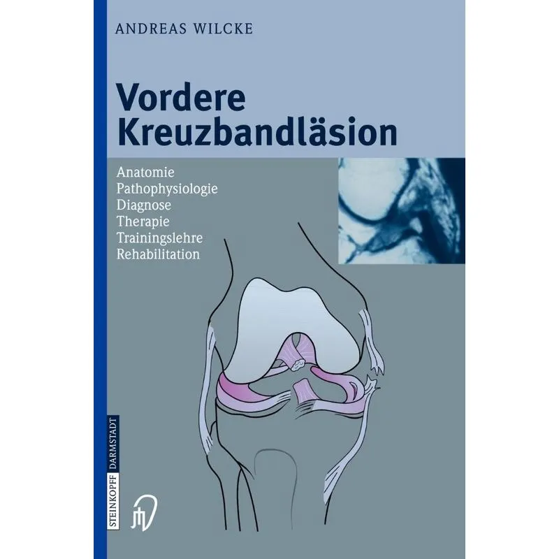Vordere Kreuzbandlasion