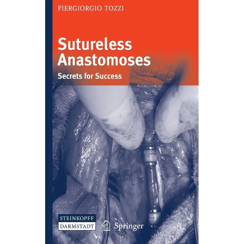Sutureless Anastomoses