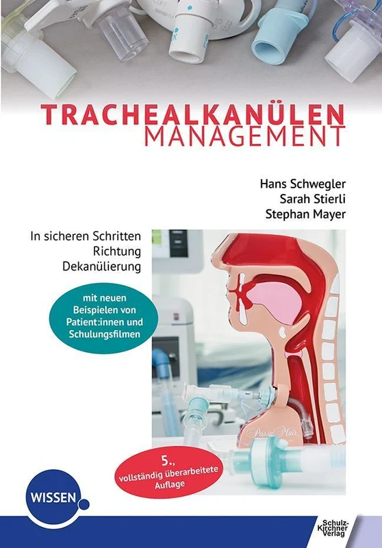 Trachealkanülenmanagement