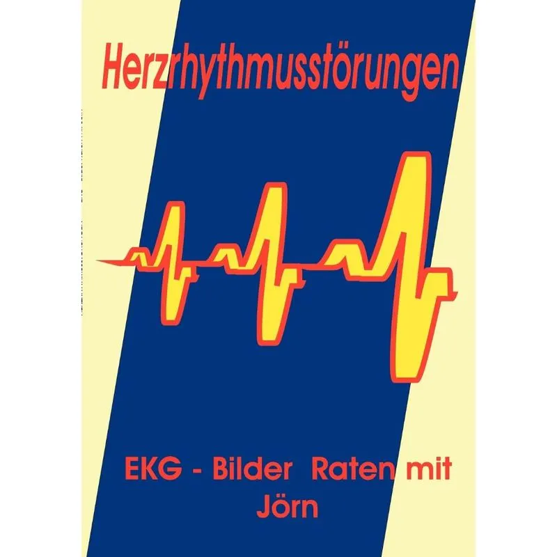 Herzrhythmusstörungen