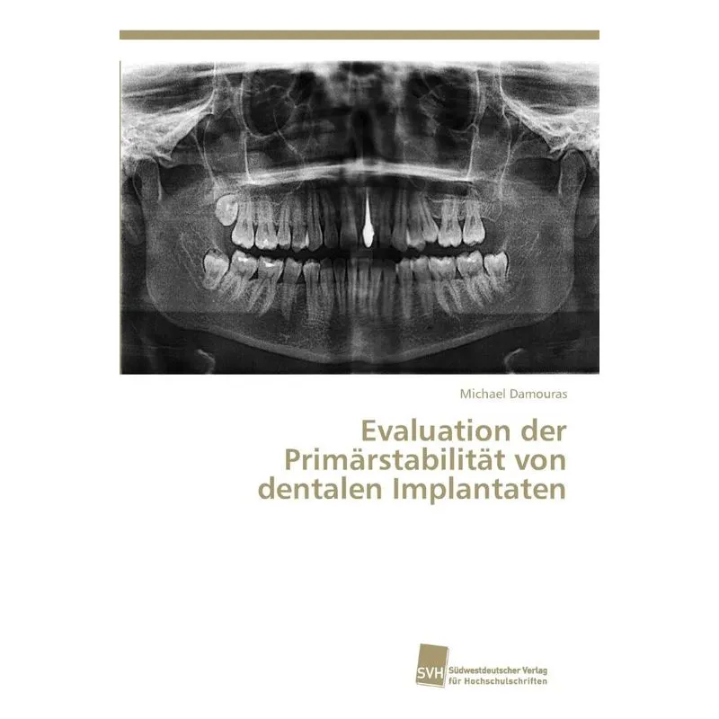 Evaluation der Primärstabilität von dentalen Implantaten