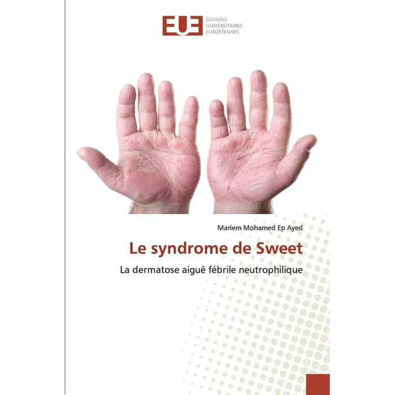Le syndrome de Sweet