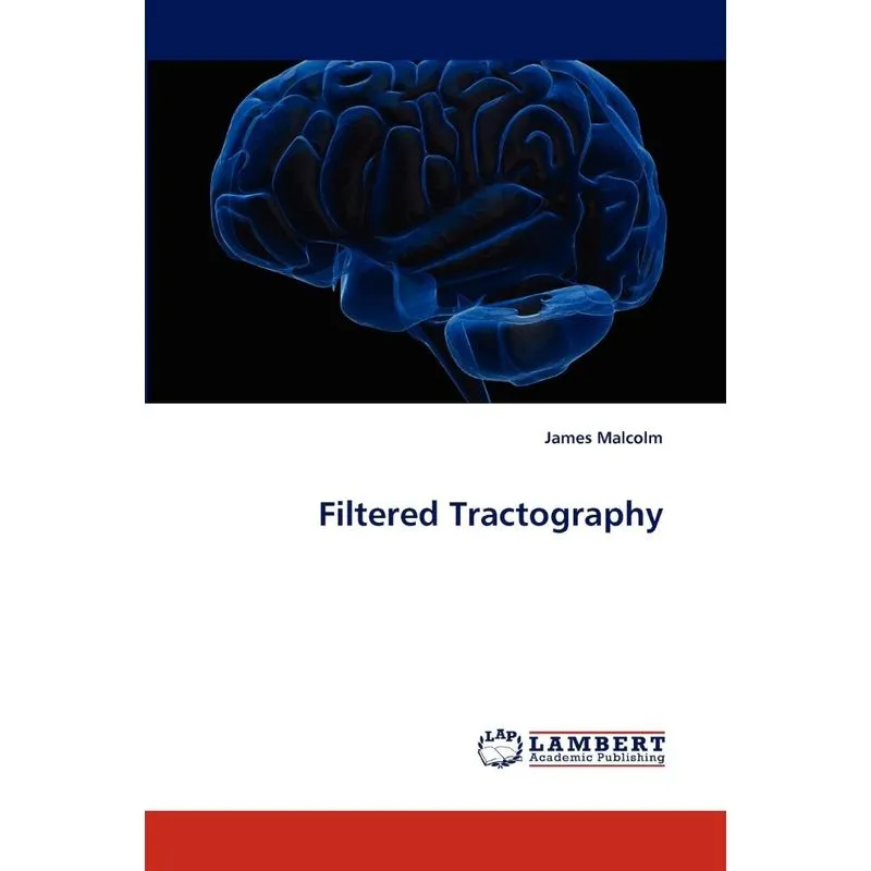 Filtered Tractography