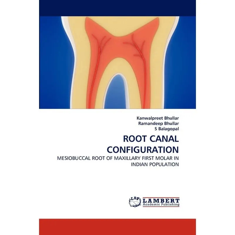 Root Canal Configuration