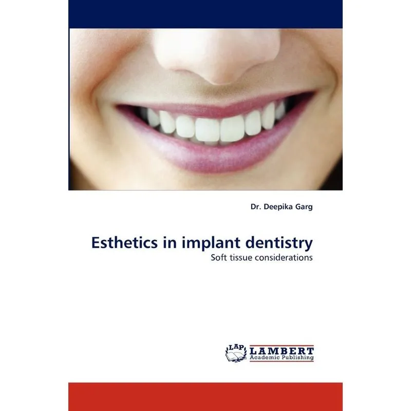 Esthetics in Implant Dentistry