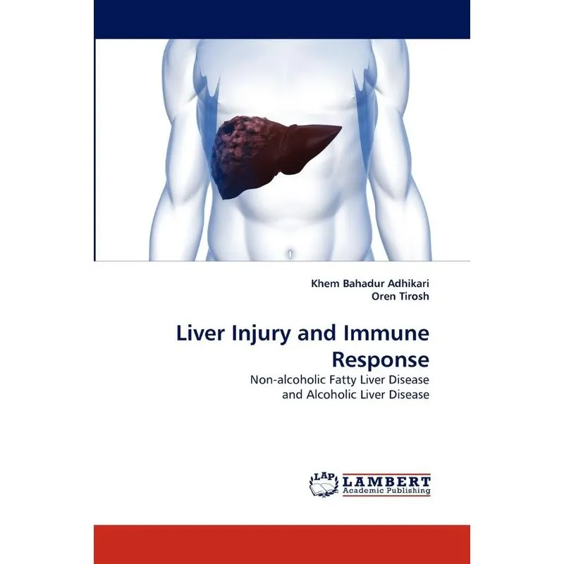 Liver Injury and Immune Response