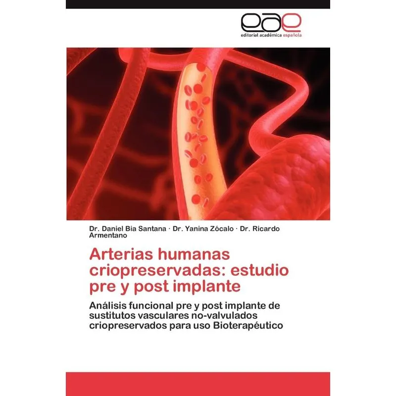 Arterias Humanas Criopreservadas