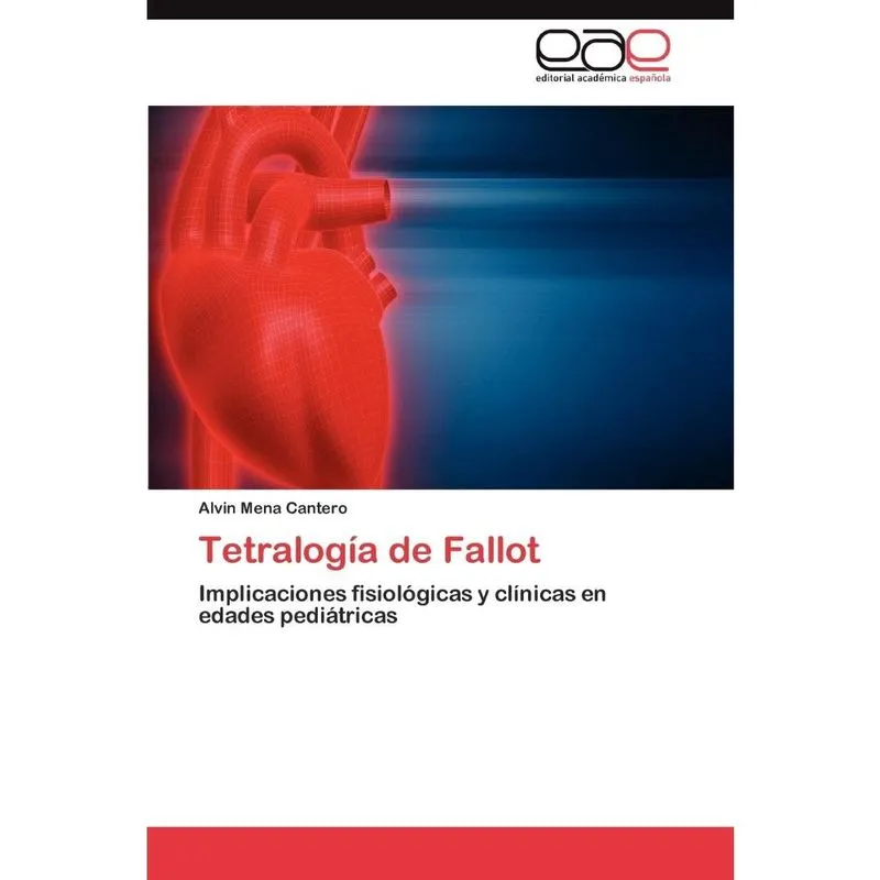 Tetralogia de Fallot