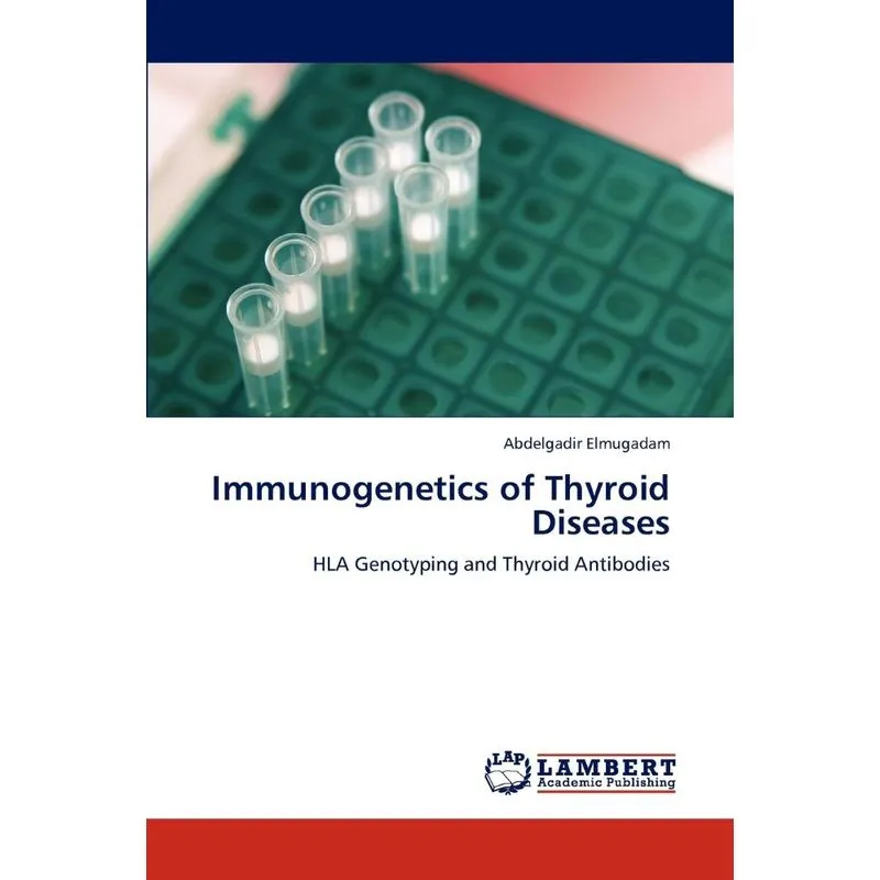 Immunogenetics of Thyroid Diseases
