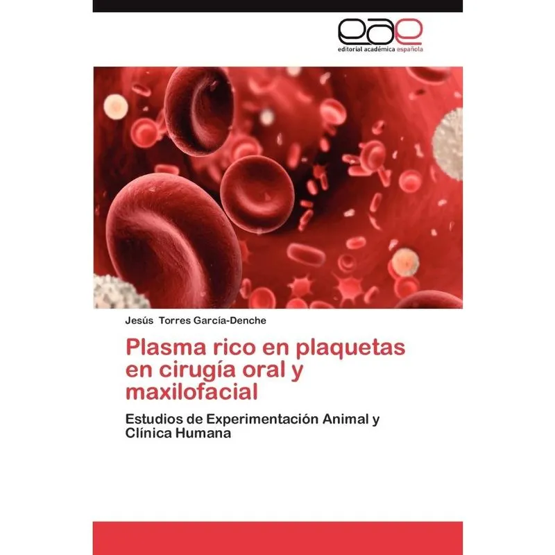 Plasma Rico En Plaquetas En Cirugia Oral y Maxilofacial