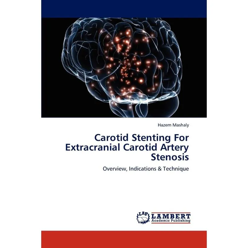 Carotid Stenting For Extracranial Carotid Artery Stenosis