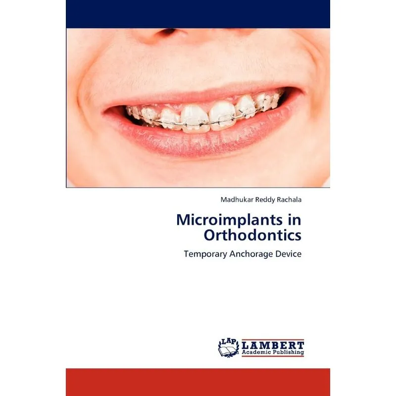 Microimplants in Orthodontics