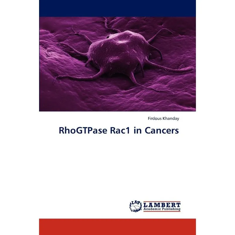 RhoGTPase Rac1 in Cancers