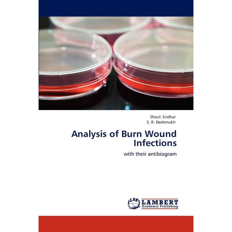Analysis Of Burn Wound Infections